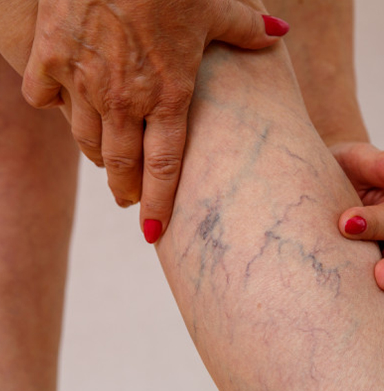 Angiología y cirugía vascular