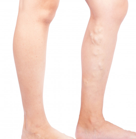 Clínica de angiología y cirugía vascular
