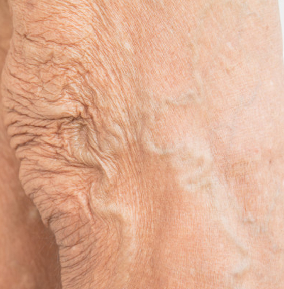 Clínica de angiología