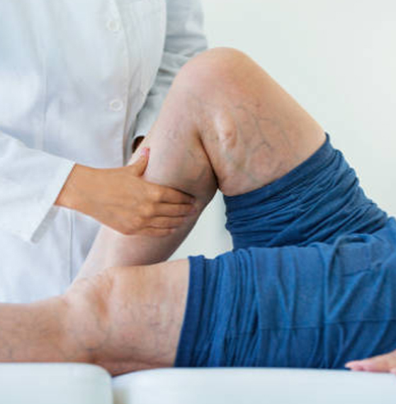 Eliminación de várices precio