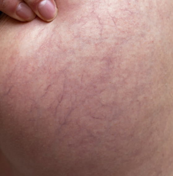 Especialista angiólogo