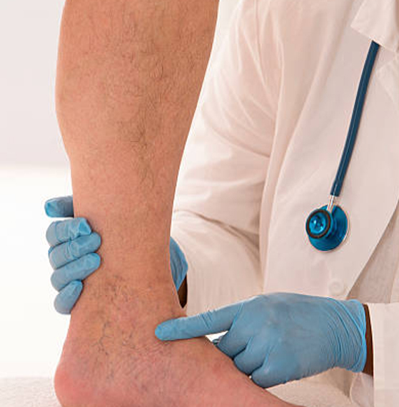 Tratamiento para pie diabético